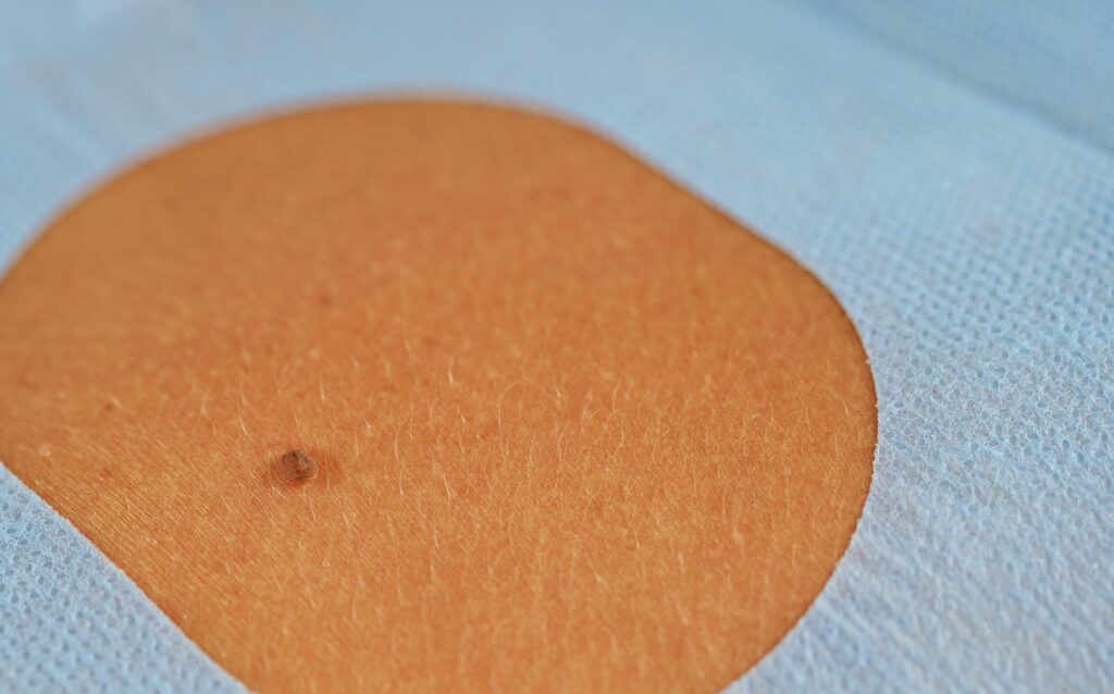 Skin patch illustrating the use of lanolin in pharmaceutical applications.